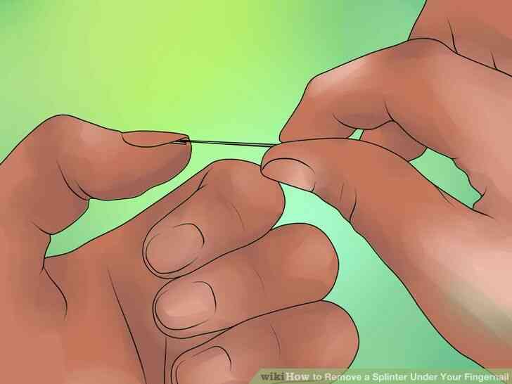 Image intitulée Enlever une Écharde Sous Ton Ongle Étape 4